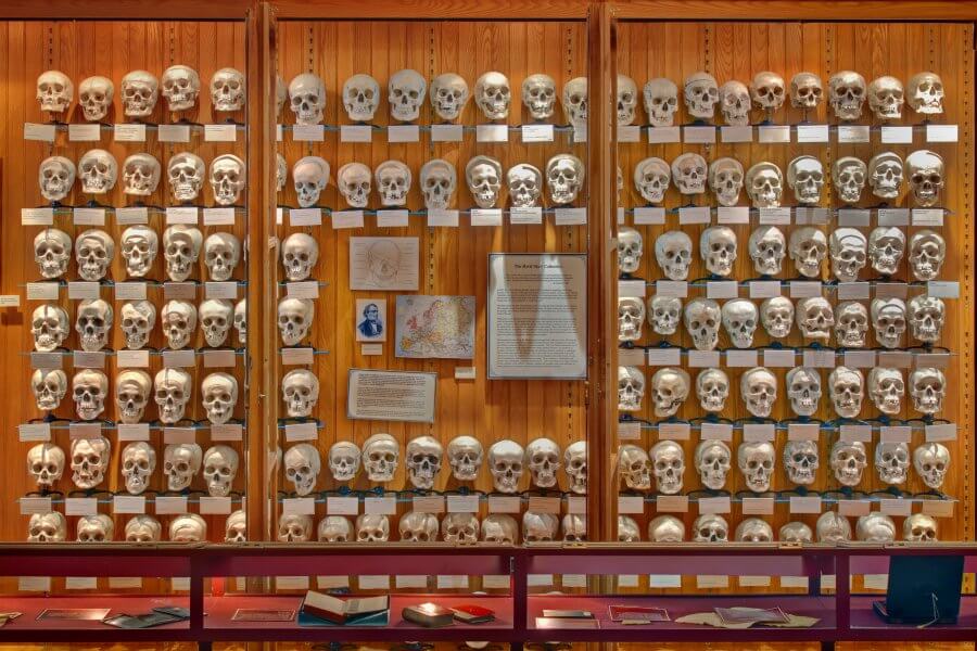 Коллекция черепов в музее Мюттера